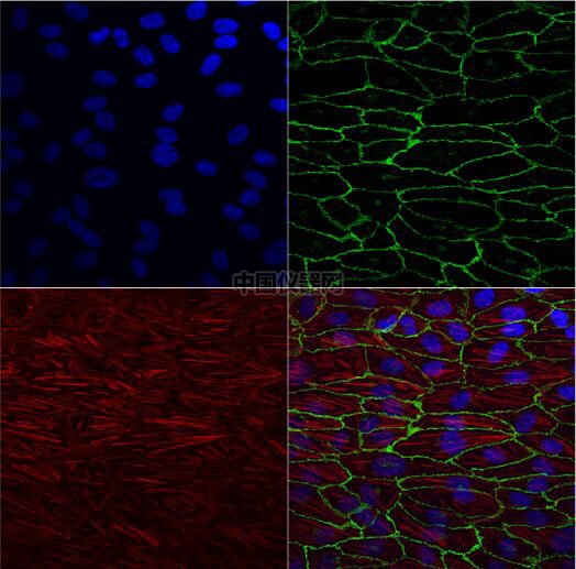 流體剪切力實驗：流體環(huán)境下的HUVEC細胞培養(yǎng)，真實還原體內(nèi)環(huán)境