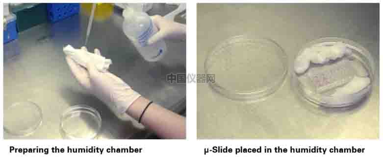 血管生成--甲狀腺轉(zhuǎn)錄因子-1（TTG-1）影響肺癌細(xì)胞血管生成