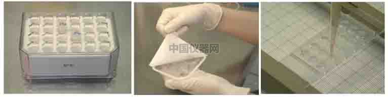 血管生成--甲狀腺轉(zhuǎn)錄因子-1（TTG-1）影響肺癌細(xì)胞血管生成